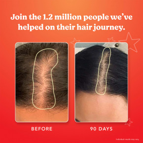 HAIRtamin, Gummy Stars ™, смесь суперфруктов, 60 веганских жевательных мармеладок в Москве - eco-herb.ru | фото