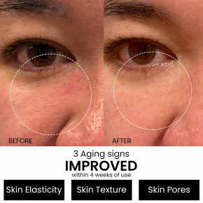 Kleem Organics, Booster с ретинолом, 30 мл (1 жидк. унция) в Москве - eco-herb.ru | фото