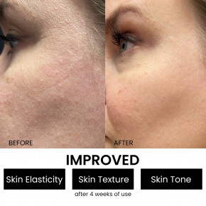 Kleem Organics, бустер с пептидным комплексом, 30 мл (1 жидк. унция) в Москве - eco-herb.ru | фото