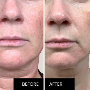 Kleem Organics, Jeunesse, профессиональная антивозрастная сыворотка с витамином C, 50 мл (1,7 жидк. унции) в Москве - eco-herb.ru | фото