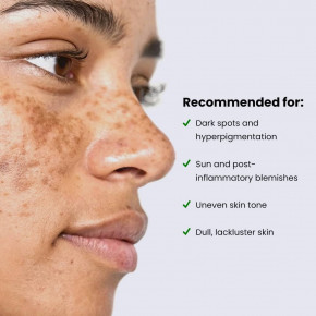 Kleem Organics, ночная сыворотка, корректирующая темные пятна, 30 мл (1 жидк. унция) в Москве - eco-herb.ru | изображение Kleem Organics, ночная сыворотка, корректирующая темные пятна, 30 мл (1 жидк. унция) в Москве - eco-herb.ru | фото