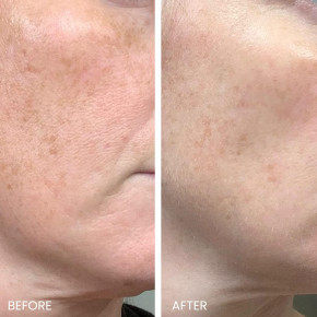 Kleem Organics, ночная сыворотка, корректирующая темные пятна, 30 мл (1 жидк. унция) в Москве - eco-herb.ru | изображение Kleem Organics, ночная сыворотка, корректирующая темные пятна, 30 мл (1 жидк. унция) в Москве - eco-herb.ru | фото