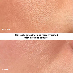 Kleem Organics, Сыворотка с гиалуроновой кислотой, 30 мл (1 жидк. унц.) в Москве - eco-herb.ru | изображение Kleem Organics, Сыворотка с гиалуроновой кислотой, 30 мл (1 жидк. унц.) в Москве - eco-herb.ru | фото