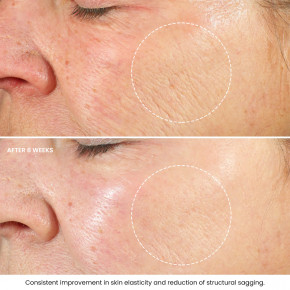 Kleem Organics, улучшенный увлажняющий крем с ретинолом, антивозрастное средство, 50 мл (1,7 жидк. унции) в Москве - eco-herb.ru | фото